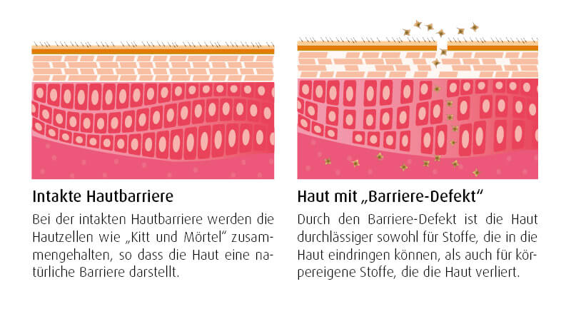 Haut-Barrieren-Effekt