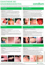 Poster Exantheme bei Kinderkrankheiten